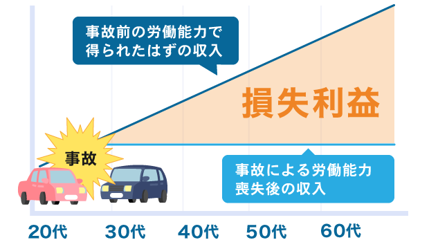 逸失利益