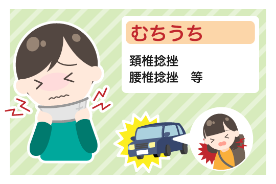 むちうちの症状と治療期間の目安